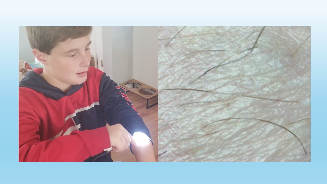 Tent™ skin imaging device