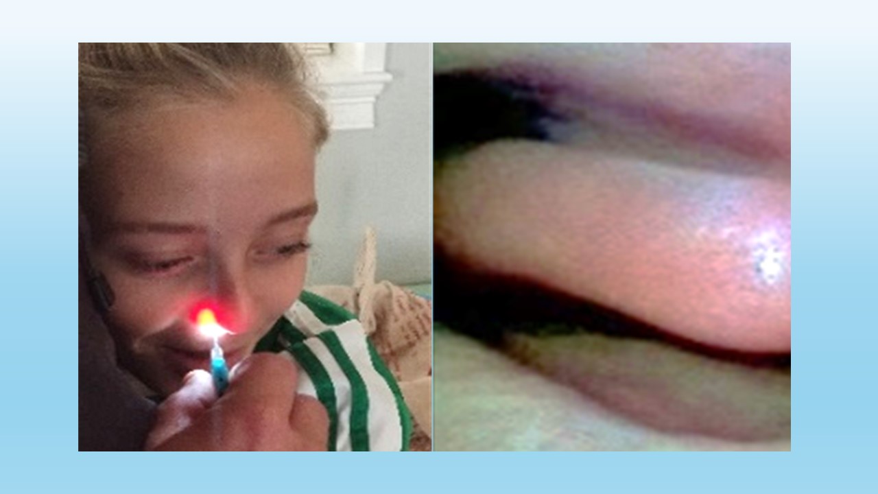 Iris™ nasal imaging
